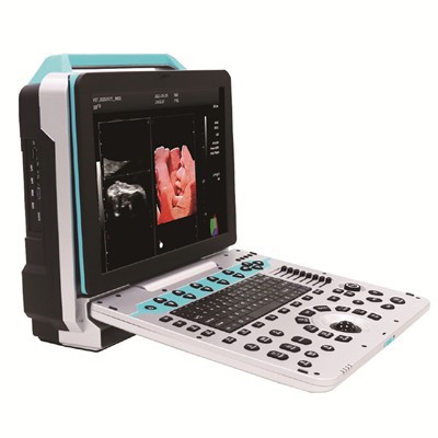 Pārnēsājams krāsu ultraskaņas diagnostikas aparāts